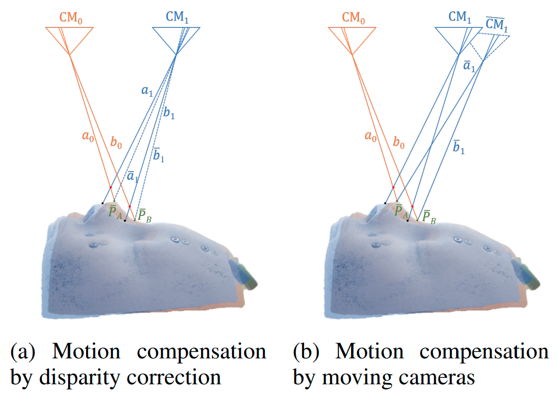 Patient Motion Compensation Paper